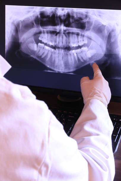 Best Emergency Root Canal Therapy in Park Center, CO