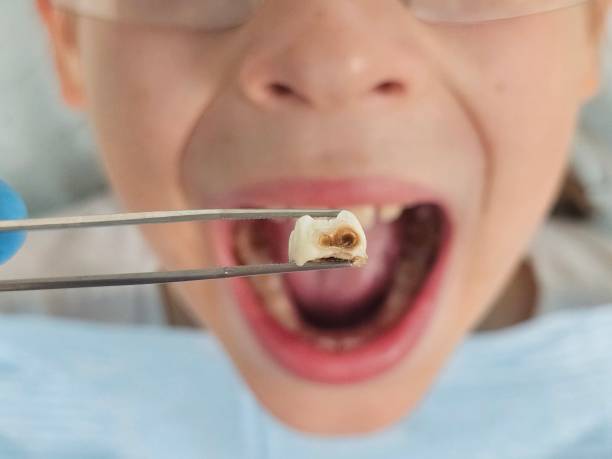 Best Urgent Dental Care for Toothaches in Park Center, CO